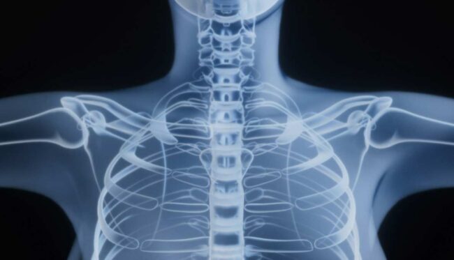 Radiología intervencionista